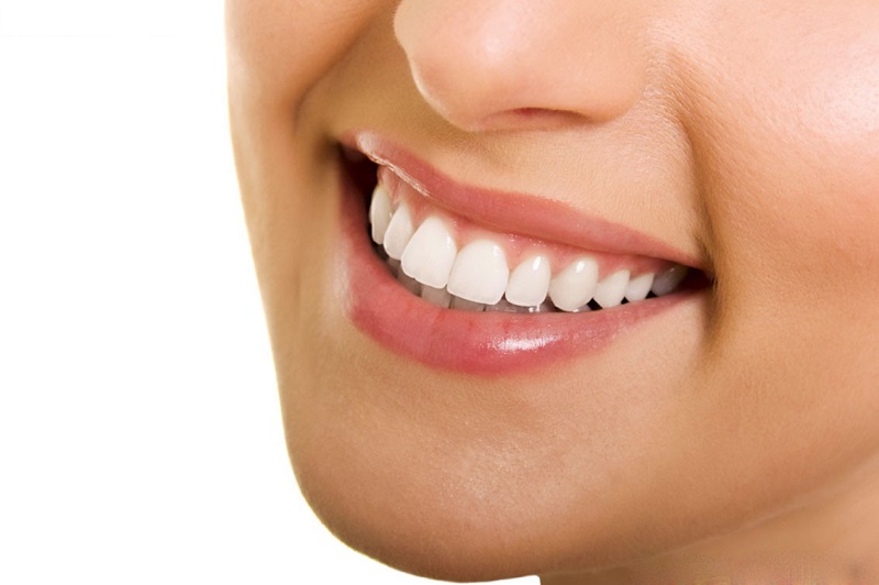 Chi phí phục hình răng sứ sẽ tăng theo số lượng răng mà bạn cần thực hiện.
