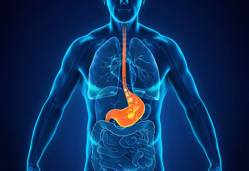 Hiểu về trào ngược và tác động của trào ngược lên cổ họng