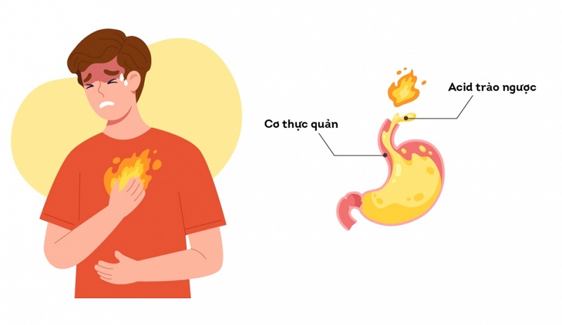 Đau rát ngực vào ban đêm nguyên nhân do đâu?