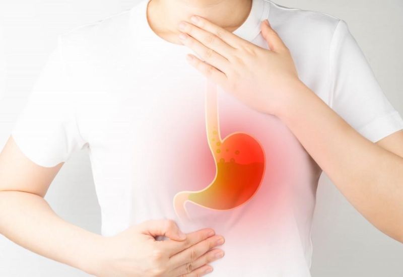 Trào ngược dạ dày - thực quản (GERD) gây ợ nóng nhiều