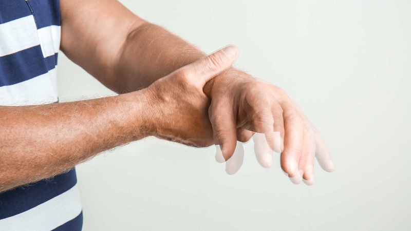 Parkinson là bệnh gì?