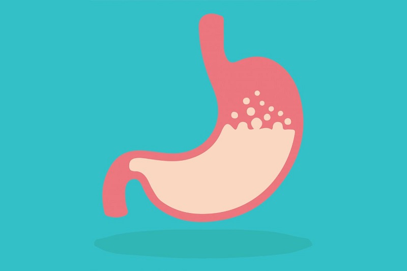 Ợ nóng do GERD hay do đâu?