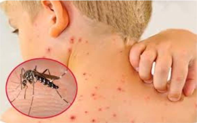 Sốt xuất huyết ở trẻ em triệu chứng thế nào