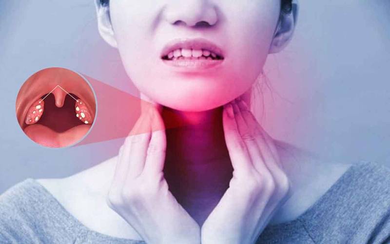 Bệnh viêm amidan chữa thế nào