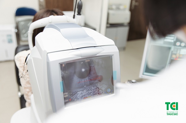 chụp cắt lớp võng mạc OCT