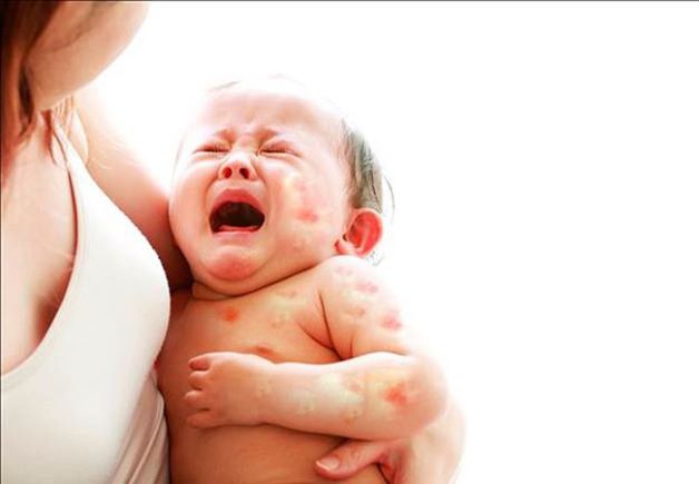 Trẻ sơ sinh nếu bị rối loạn chuyển hóa Galactosesẽ không hấp thụ được loại đường này, do đó đường Galactose khi hấp thụ vào cơ thể sẽ tích tụ và trở thành độc tố gây tổn thương gan, não, thận, mắt…
