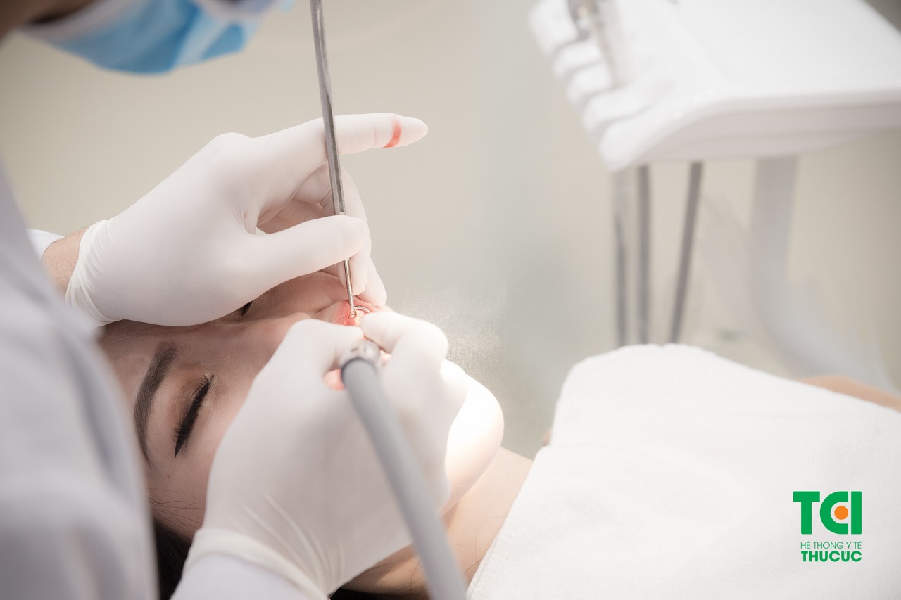Điều trị bệnh lý về tủy răng tại Bệnh viện ĐKQT Thu Cúc