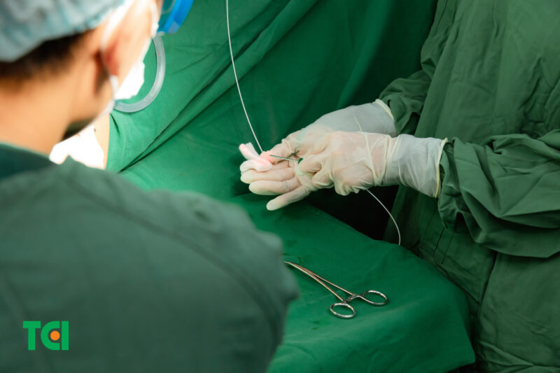 Đốt trĩ bằng Laser Diode giúp hạn chế tối đa nguy cơ biến chứng