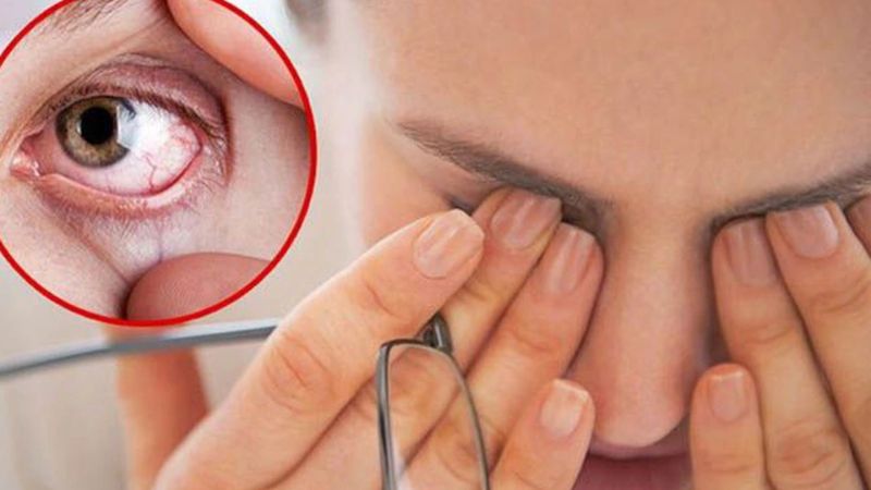 Triệu chứng của người bệnh bị cường giáp