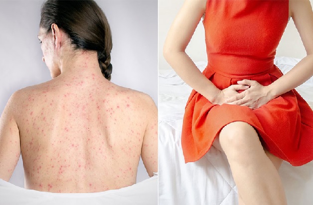 Những người quan hệ tình dục không an toàn có nguy cơ mắc bệnh xã hội