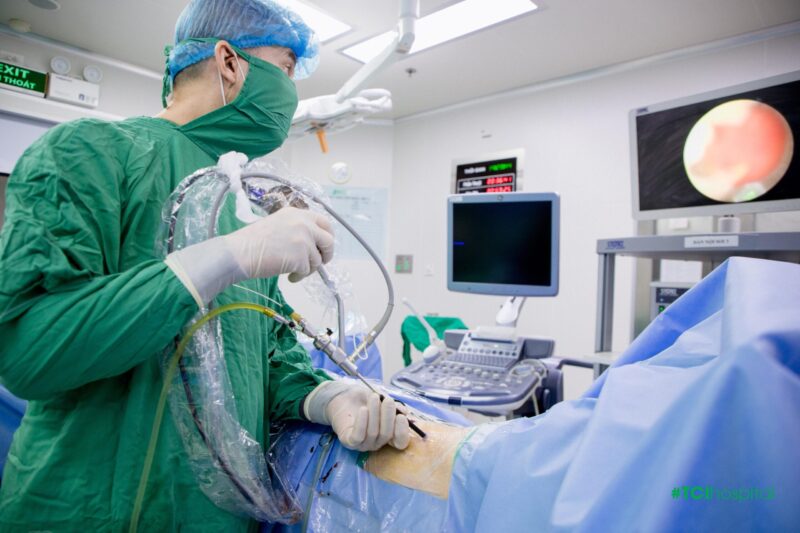 Cân não” tán sỏi san hô khổng lồ bảo toàn sức khỏe cho bệnh nhân hậu tai biến