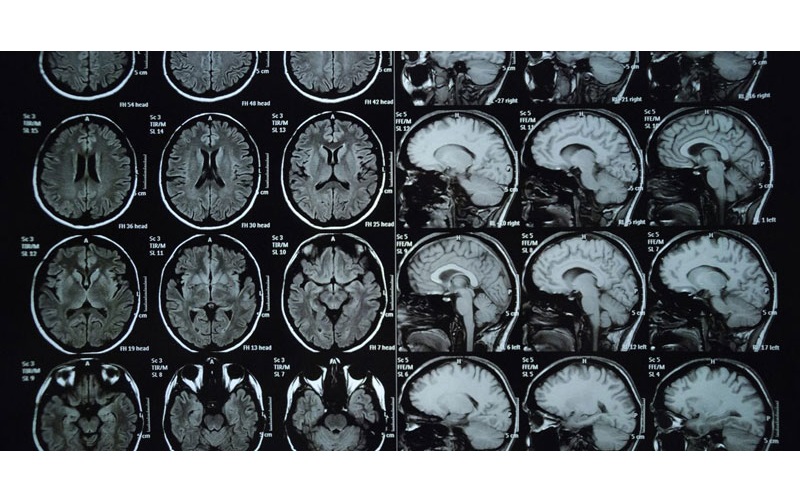 hình chụp MRI