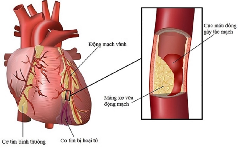 chụp cộng hưởng từ