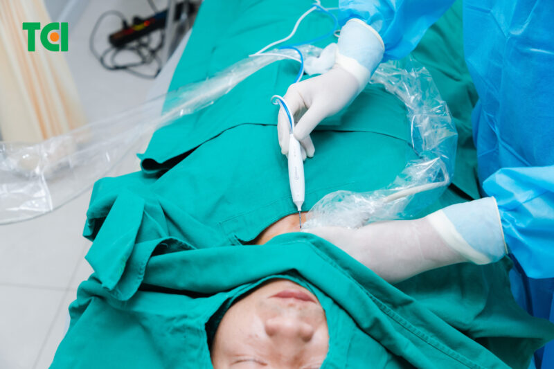 Cơ chế hoạt động của phẫu thuật u tuyến giáp lành tính bằng đốt sóng cao tần