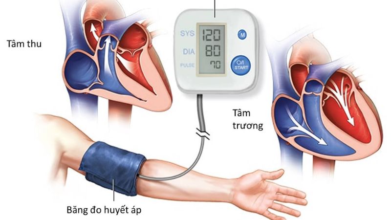 Tăng huyết áp là tình trạng gì?