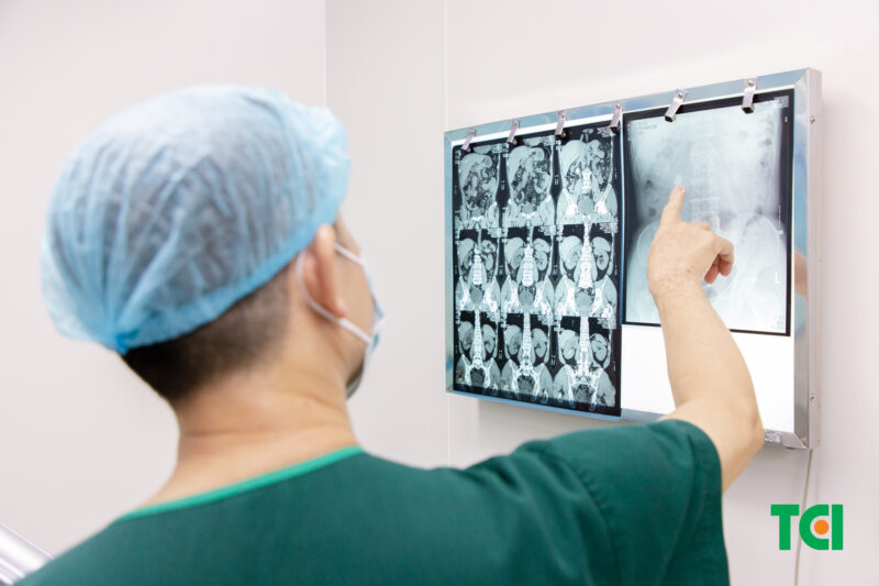 Nguyên nhân phổ biến gây giãn bể thận ở người lớn