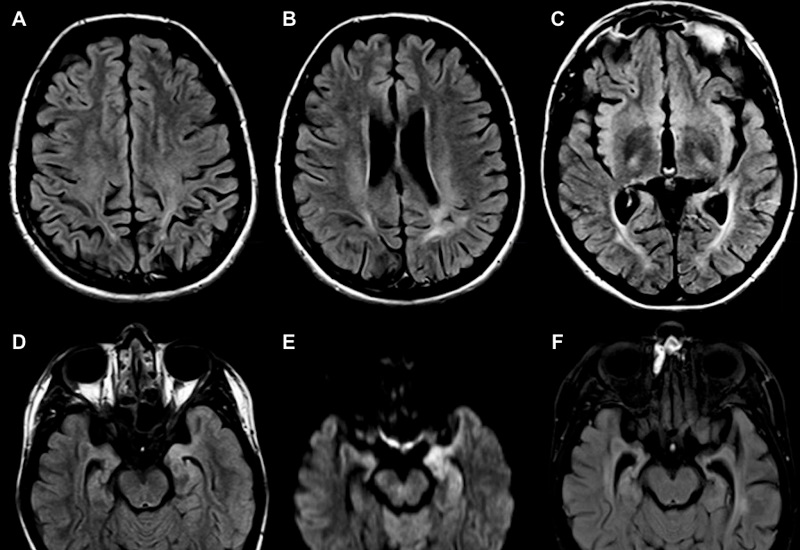 hình ảnh chụp MRI hỗ trợ phát hiện ung thư