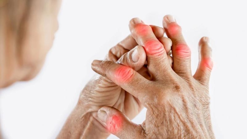 Thoái hóa ở khớp bàn tay và các ngón tay