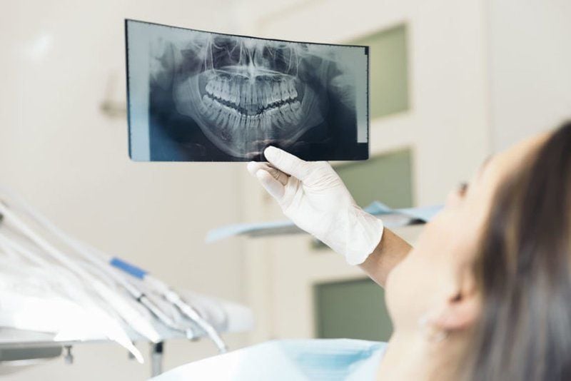 Khi nào nên thực hiện chụp Xquang răng