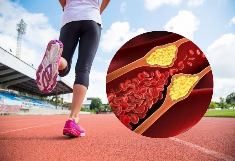 Vai trò của vận động đối với người bị mỡ máu cao