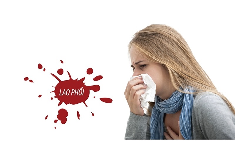 Đường lây nhiễm của lao 