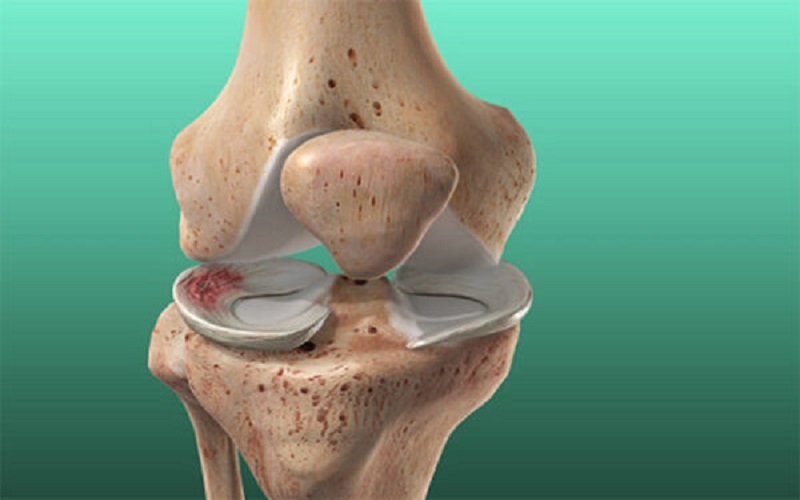khả năng phục hồi còn tùy thuộc vào vị trí rách