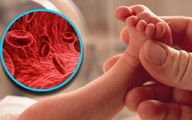 Trẻ sơ sinh bị thiếu máu mẹ nên ăn gì được