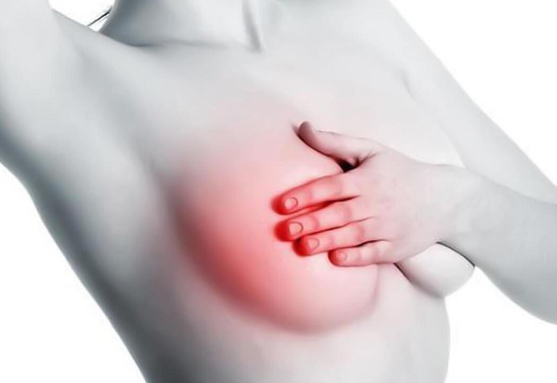 ung thư vú có chữa được không