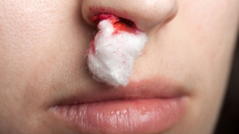 Vì sao huyết áp cao chảy máu cam?