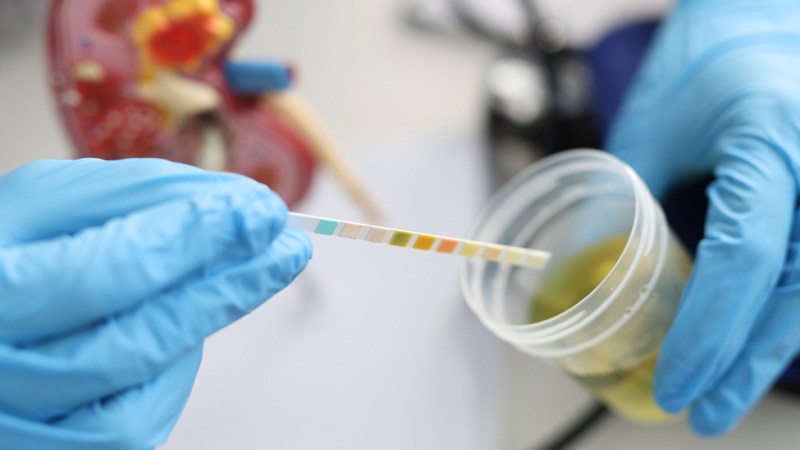 pH nước tiểu bằng 8 có sao không