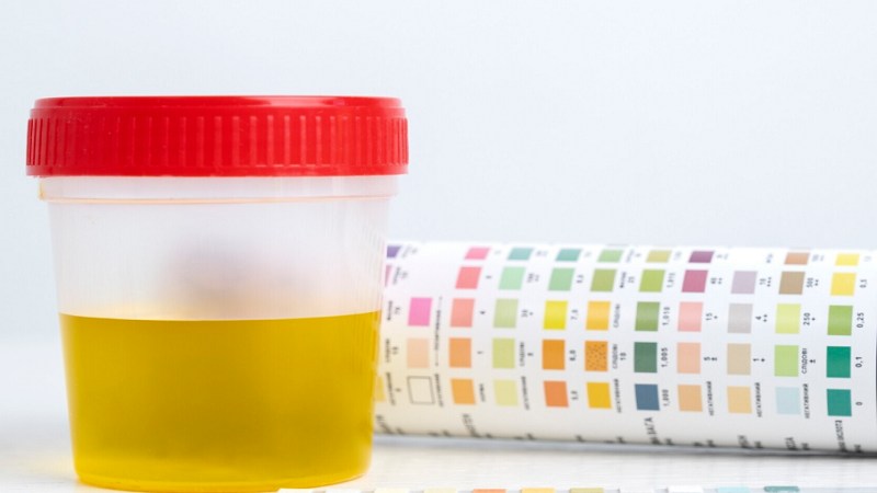 pH nước tiểu bằng 8 có sao không