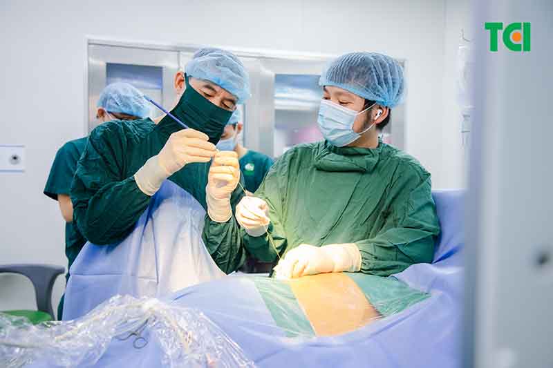 Kích thước sỏi 29mm có cần mổ không?