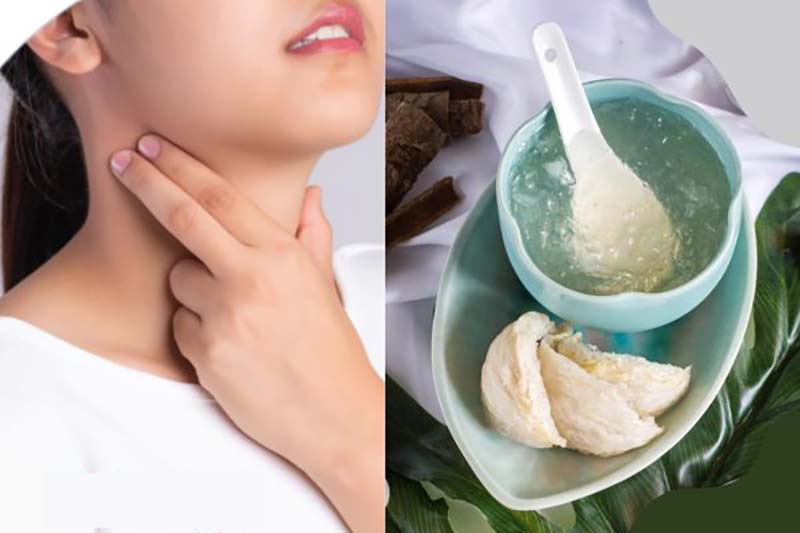 Người bị ung thư vòm họng đau rát cổ kết hợp hình ảnh bát yến sào chưng – món ăn mềm, dễ nuốt hỗ trợ cải thiện dinh dưỡng cho bệnh nhân