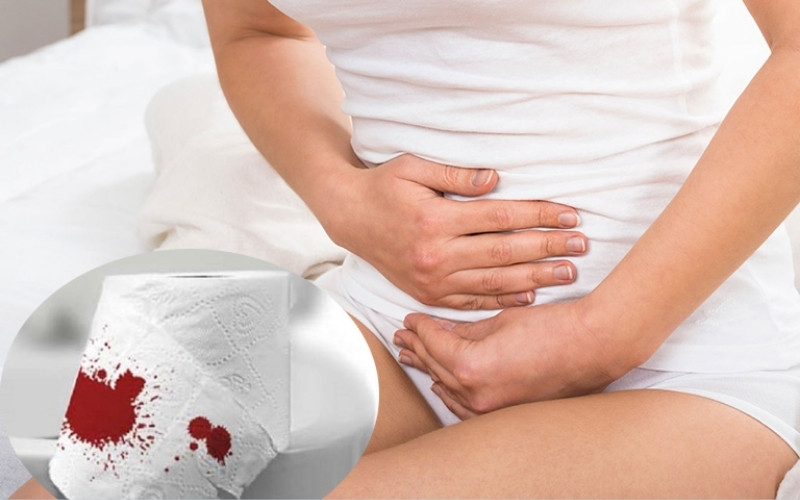hậu môn ra máu tươi là bệnh gì
