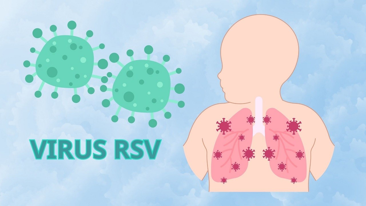 DẤU HIỆU NHIỄM RSV Ở TRẺ SƠ SINH BAO GỒM THỞ NHANH VÀ RÚT LÕM LỒNG NGỰC