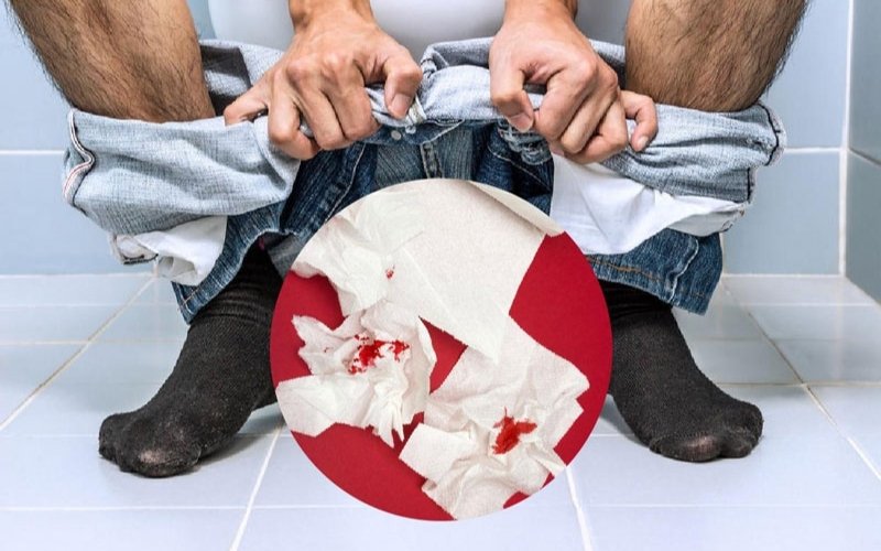 hậu môn tiết ra chất nhầy