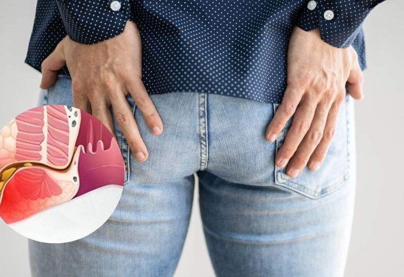 hậu môn bị sưng phồng phải làm sao