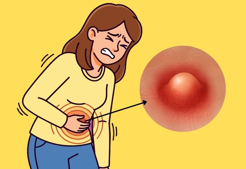 áp xe thành bụng