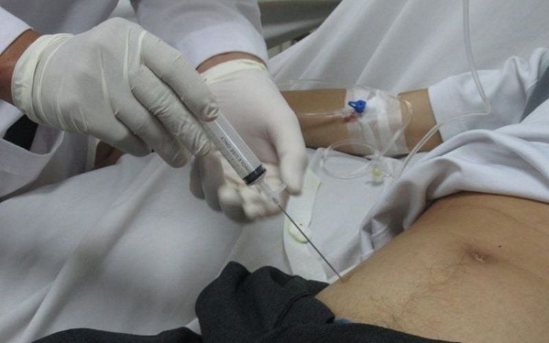 chọc hút áp xe thành bụng