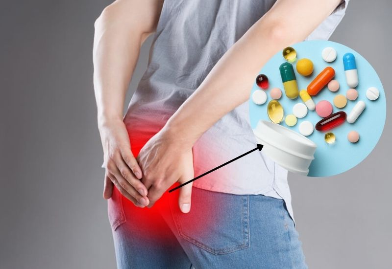 áp xe hậu môn uống thuốc gì
