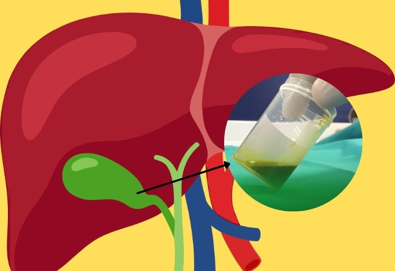 cơ quan nào tiết ra dịch mật