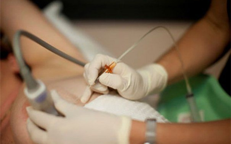 chọc dẫn lưu ổ áp xe dưới siêu âm