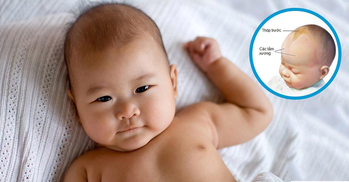 Thóp trước của trẻ thường đóng trong khoảng 7–18 tháng tuổi, trung bình khoảng 13–14 tháng.