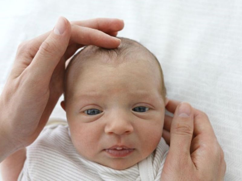 Thóp giúp hộp sọ có không gian thích nghi với sự phát triển nhanh của não bộ và cũng là dấu hiệu tham khảo quan trọng để theo dõi tình trạng sức khỏe của trẻ.
