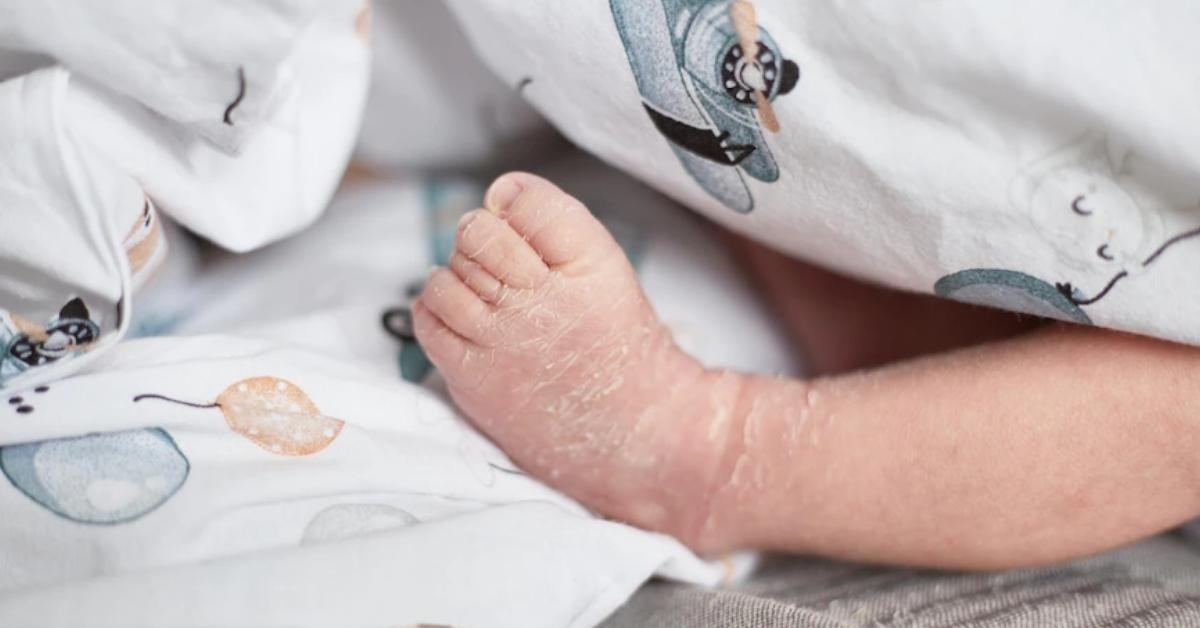 Trẻ sinh non, nhẹ cân hoặc có vấn đề sức khỏe đặc biệt nên được bác sĩ tư vấn trước khi nằm điều hòa; đồng thời tránh để luồng gió lạnh, khô thổi trực tiếp vào bé.